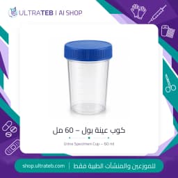 كوب عينة بول ٦٠ مل بغطاء لولبي وتدريجات مطبوعة — للاستخدام مرة واحدة